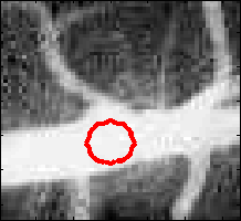 Image vessel-initial