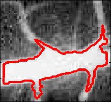 Image vessel-intermediate