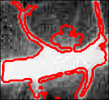 Image vessel-leakage